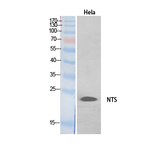 NTS Polyclonal Antibody