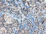 IGF2BP3 Polyclonal Antibody