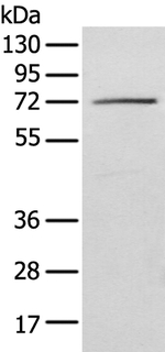 IGF2BP3 Antibody in Western Blot (WB)