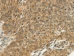 PSMD10 Polyclonal Antibody