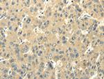 FABP8 Polyclonal Antibody