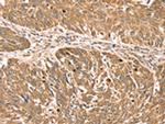 RPLP2 Polyclonal Antibody