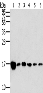 RPLP2 Antibody in Western Blot (WB)