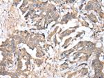 TIM17 Antibody in Immunohistochemistry (Paraffin) (IHC (P))