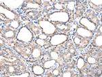 TIM17 Polyclonal Antibody