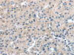 ITPA Polyclonal Antibody