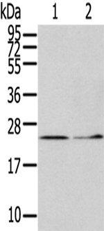 ITPA Antibody in Western Blot (WB)
