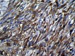 TSSC1 Polyclonal Antibody