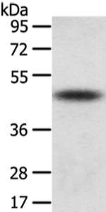 TTC23 Antibody in Western Blot (WB)