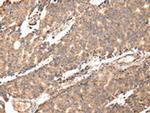 UGGT2 Polyclonal Antibody