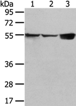 UGT1A10 Polyclonal Antibody