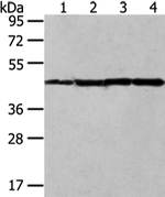 UQCRC2 Antibody in Western Blot (WB)