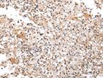 UXT Polyclonal Antibody