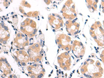 VDAC3 Polyclonal Antibody