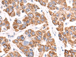 VDAC3 Antibody in Immunohistochemistry (Paraffin) (IHC (P))