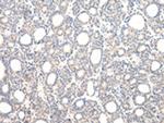 VPS33B Polyclonal Antibody