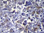 VPS37A Polyclonal Antibody