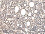 VPS37D Polyclonal Antibody