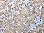 WDR4 Polyclonal Antibody
