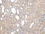 WDR85 Polyclonal Antibody