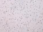 WISP3 Polyclonal Antibody
