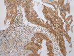 WSB1 Polyclonal Antibody