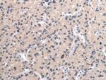 MORC2 Antibody in Immunohistochemistry (Paraffin) (IHC (P))