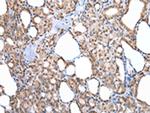 MORC2 Polyclonal Antibody