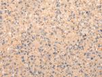 ZFAND1 Polyclonal Antibody