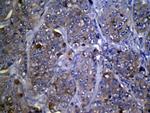 ZFP2 Polyclonal Antibody