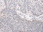 ZNF239 Polyclonal Antibody