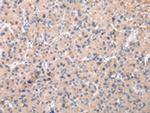 ZNF268 Polyclonal Antibody