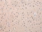 ZCCHC9 Polyclonal Antibody