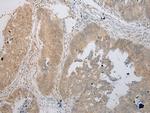 TIGD5 Polyclonal Antibody