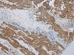 TIGD5 Antibody in Immunohistochemistry (Paraffin) (IHC (P))