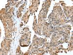 EML4 Polyclonal Antibody