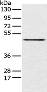 PCID2 Antibody in Western Blot (WB)