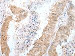 DTWD1 Polyclonal Antibody