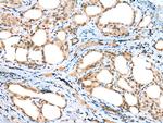 DTWD1 Antibody in Immunohistochemistry (Paraffin) (IHC (P))