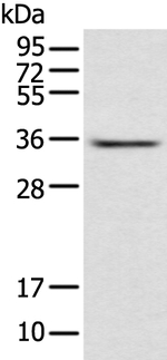 ACBD4 Antibody in Western Blot (WB)