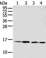 MMGT1 Antibody in Western Blot (WB)