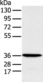MAT2B Polyclonal Antibody