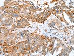 MYBPHL Antibody in Immunohistochemistry (Paraffin) (IHC (P))