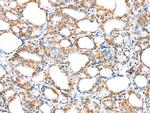 MYBPHL Polyclonal Antibody