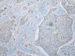 UBXN2B Polyclonal Antibody