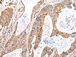KCTD16 Polyclonal Antibody