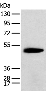 KCTD16 Antibody in Western Blot (WB)