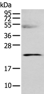 C8G Antibody in Western Blot (WB)