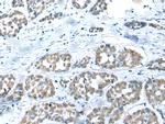 COMMD6 Polyclonal Antibody