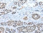C22orf41 Polyclonal Antibody